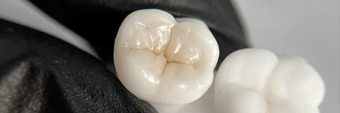 prevention-buccale-tourcoing-efficace