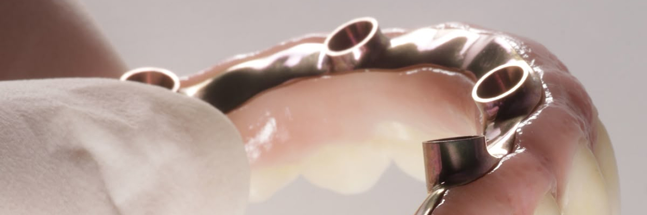 solutions-buccales-tourcoing-durables