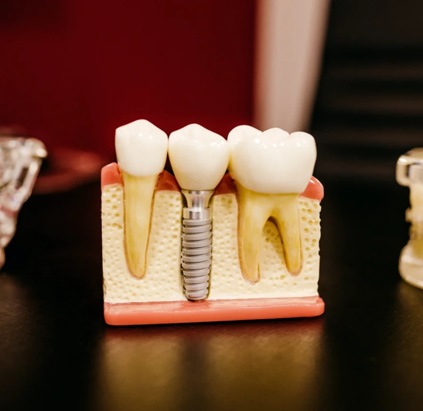 dentisterie-esthetique-tourcoing-soins-personnalises