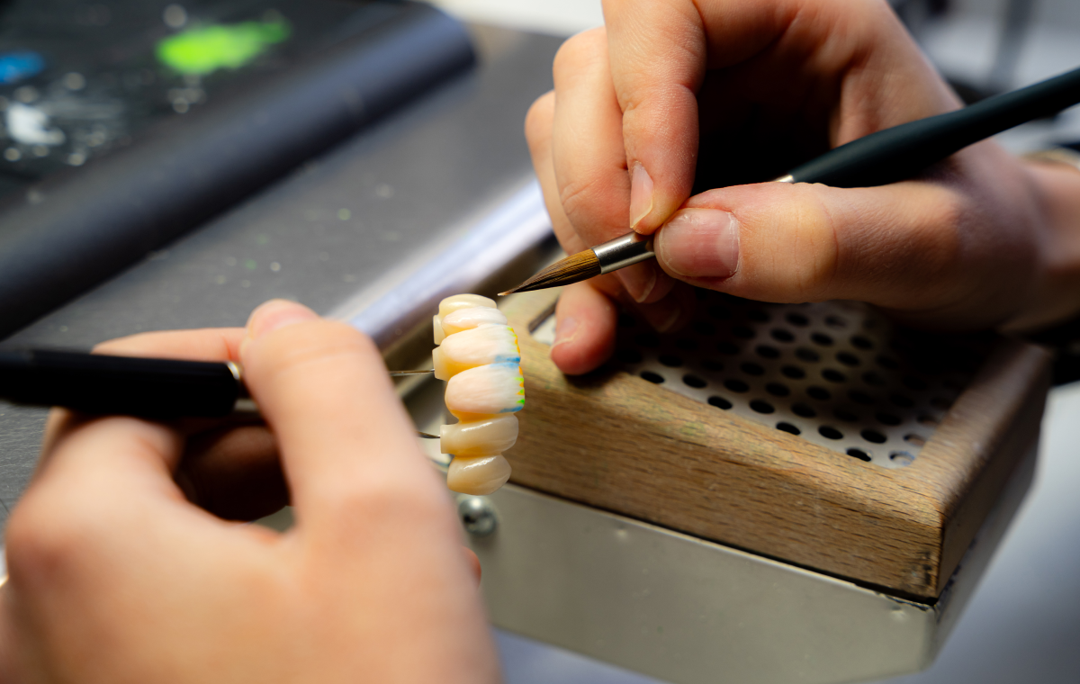 implants-dentaires-tourcoing-solution-durable