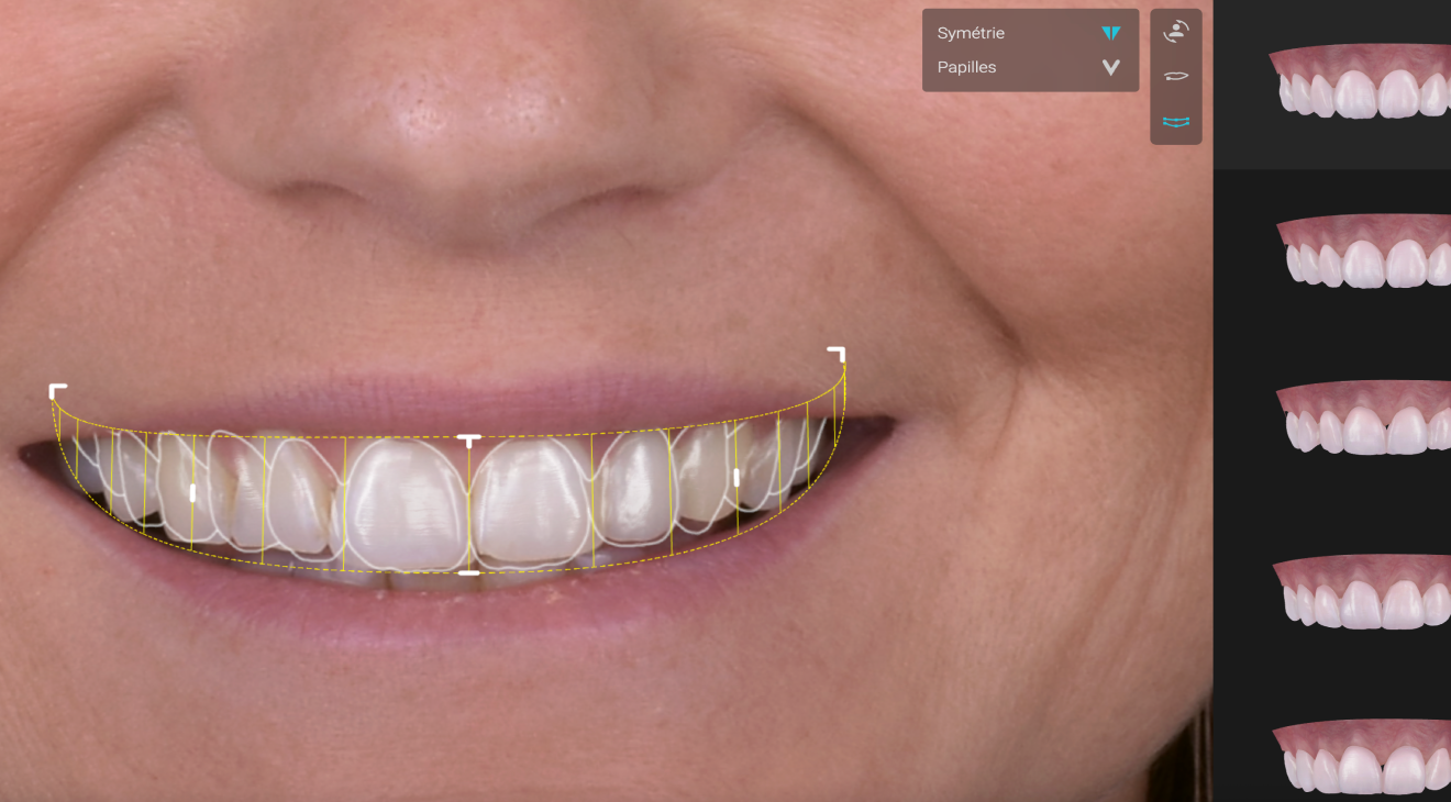smilecloud-dentiste-tourcoing