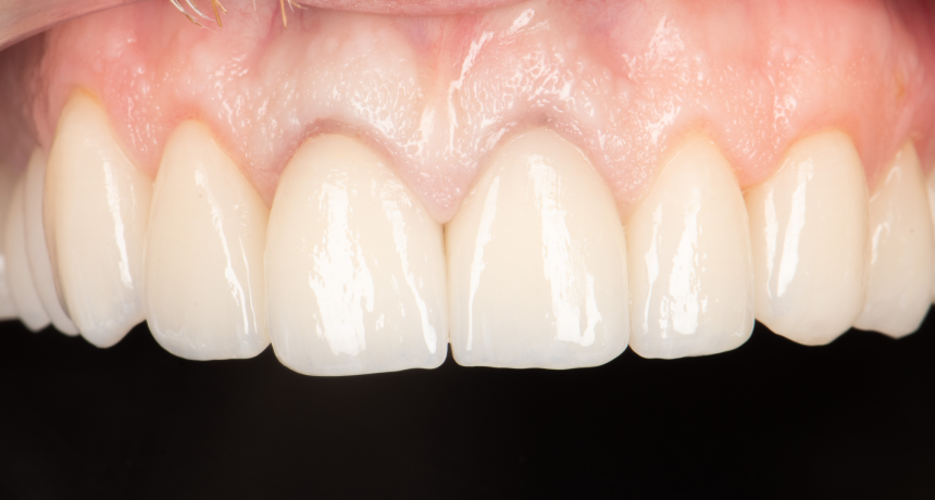 esthetique-sourire-dentiste-tourcoing