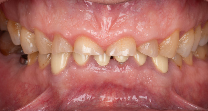 tourcoing-chirurgien-dentiste-consultation-dentaire