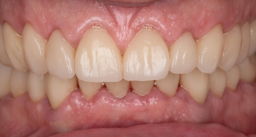 tourcoing-chirurgien-dentiste-consultation